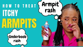 HOW I KEEP MY ARMPITS & UNDERBOOB DRY, STOP THE ITCHING THAT CAUSES RASH & WORSENS HYPERPIGMENTATION
