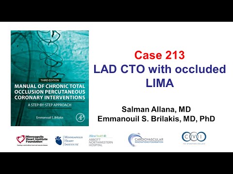 Case 213: Manual of CTO PCI - LAD in-stent CTO with occluded LIMA
