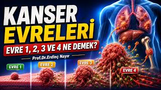 Kanser Evreleri Nedir? Evre 1, 2, 3 ve 4 Kanser Ne Demek?