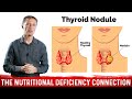 What S Behind Thyroid Nodules Thyroid Disorders Selenium Deficiency Dr Berg