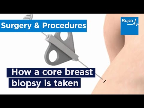 How a core breast biopsy is taken | Bupa Health