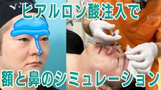 Dr.崔のアップデート企画　額と鼻のシミュレーション