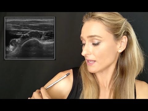 Exploración tendón Supraespinoso, NO confundir con Infraespinoso - Ecografía con Ana de Groot