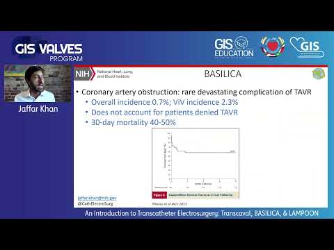 37  Jaffar Khan   An Introduction to Transcatheter Electrosurgery  Transcaval, BASILICA, & LAMPOON