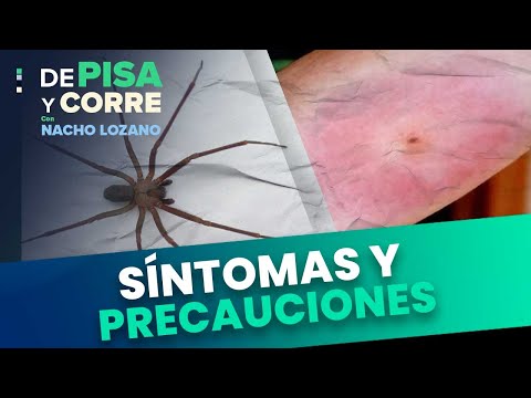 Araña Violinista: ¿Cómo son y qué hacer ante una picadura? | DPC con Nacho Lozano