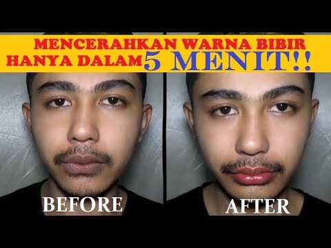 Hilangnya sebagian potensi Impotensi adalah penyakit