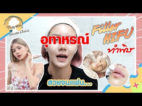 ฉีด ฟิลเลอร์ ปาก