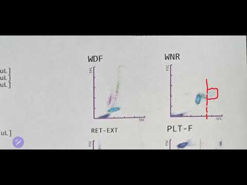 How to interpret WNR channel in Sysmex XN1000 Vet