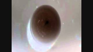 &quot;Alison&#39;s Song&quot; by The New Lew Johnson