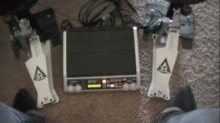Video thumbnail for Axis E-Kit Toturial by TrentLysergic