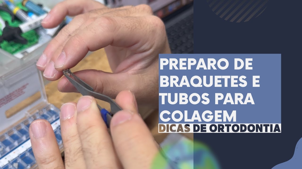 Preparação de Braquetes e Tubos para Colagem - Dica Prática de Ortodonti