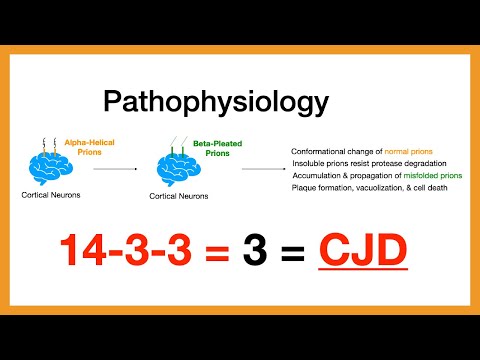 Creutzfeldt-Jakob-Krankheit (CJK)