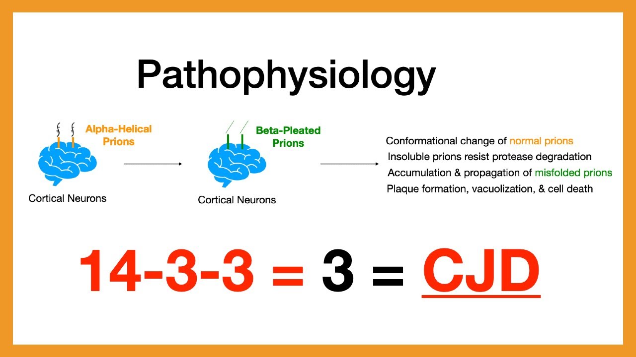 Creutzfeldt-Jakob Disease (CJD)
