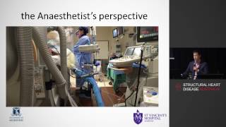 Anaesthetic Management & Imaging In Atrial Fibrillation Ablation – Dr Tuong Phan