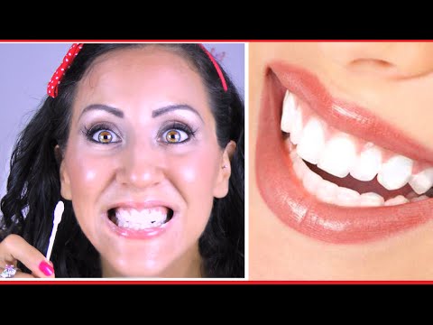 Il pigmentary nota da acne con Togliere posti di pigmentary su una faccia con aceto