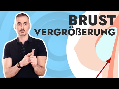 Your Plastic Surgery Coach - Breast Augmentation, everything you need to know!