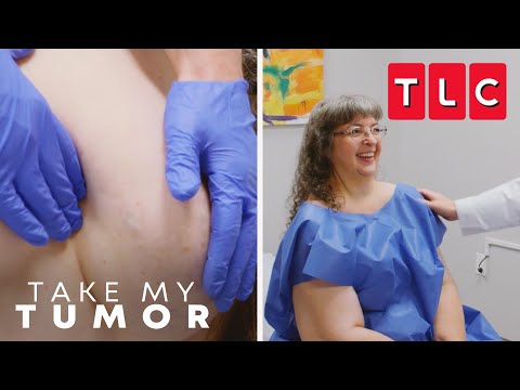 Amy Finds Help After Seventeen Years | Take My Tumor | TLC