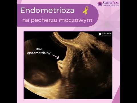 Iryna Nitefor-5
