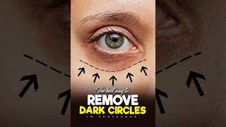 The Best Way to Remove Deep Dark Circles in Photoshop! - Photoshop Tutorial