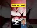 Broken Front Tooth Here S How Dentists Restore Your Smile Dentallan Dentist Shorts