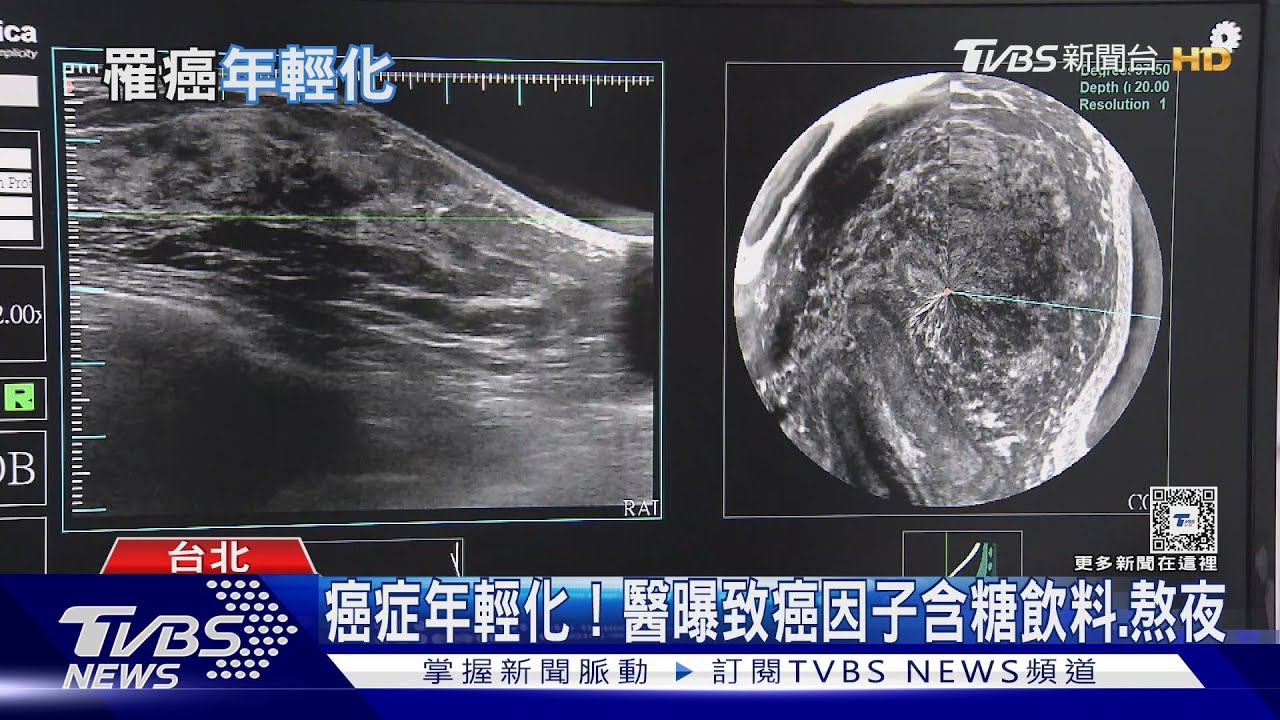 罹癌不再是老年人專利　世界多國「癌症年輕化」!