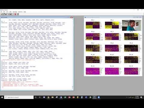 Single cell RNA-seq analysis hands on introduction 2