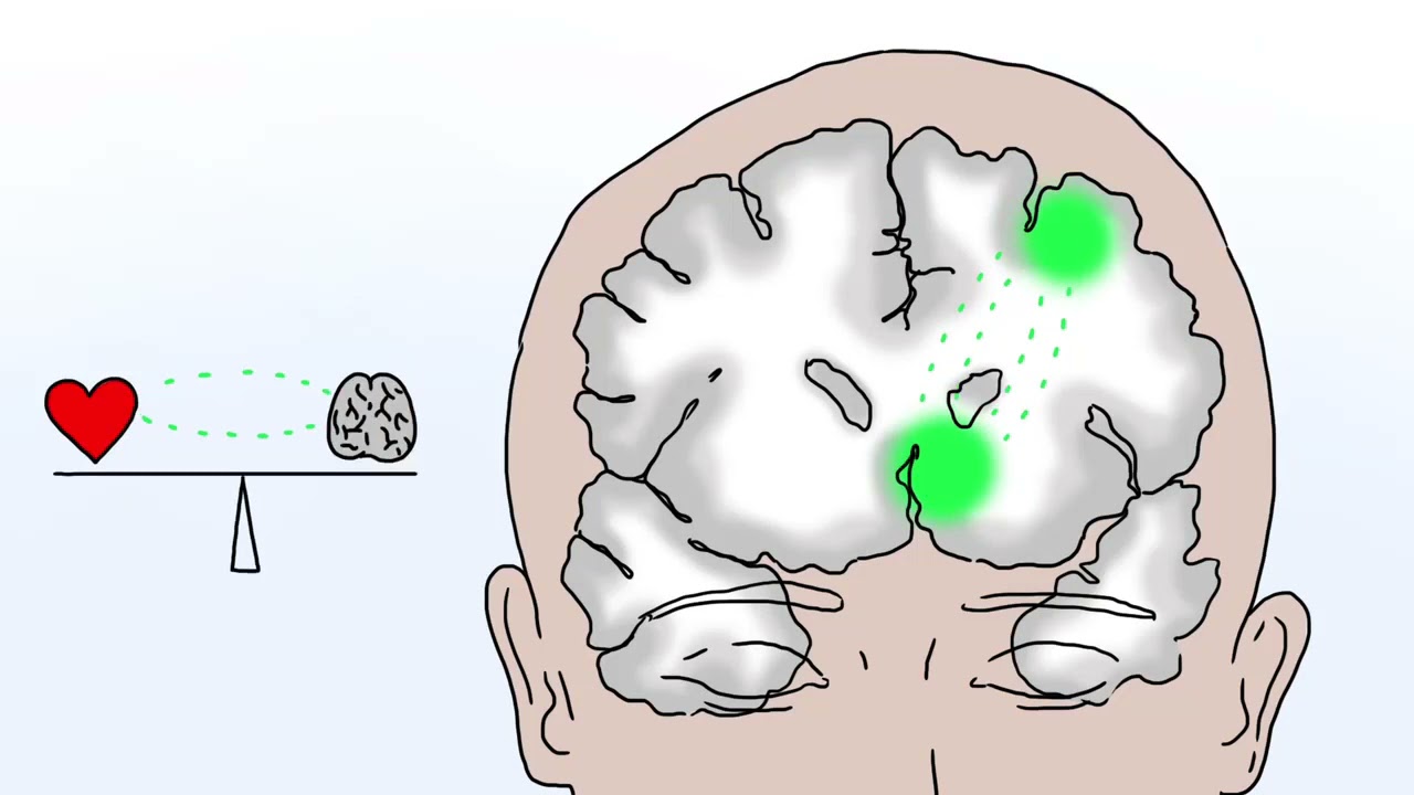 Estimulação Magnética Transcraniana - um método intensivo para tratamento de depressão resistente