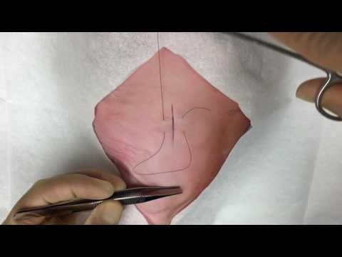 The Inverting Horizontal Mattress Suture