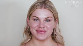 CARE Plastic Surgery | Treatment_3