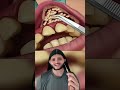 Acampamento Me Ajuda Me Seguindo React Remix Explorar Thiguees Reagindo Reagiravideos