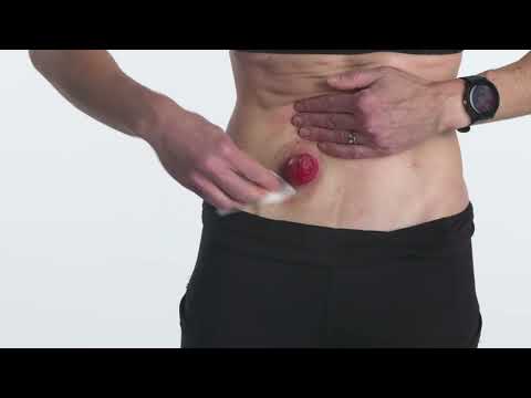 Convatec 423288 Esenta Skin Barrier Spray