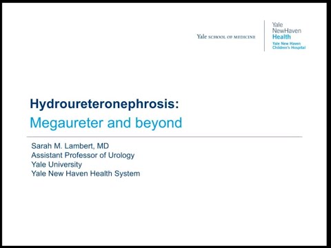 5.26.2020 PedsUroFLO Lecture - Hydroureteronephrosis: Megaureter and Beyond