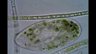 An unusually transparent <em>Paramecium bursaria</em> -- various organelles identified