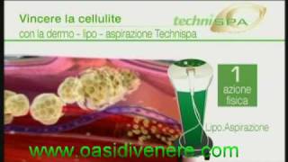 preview picture of video 'trattamento ANTI-cellulite Techni spa'