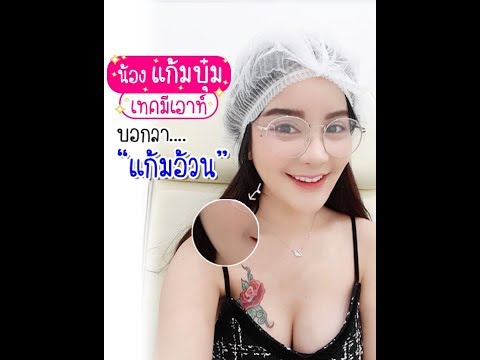 เมโสแฟตเหนียง