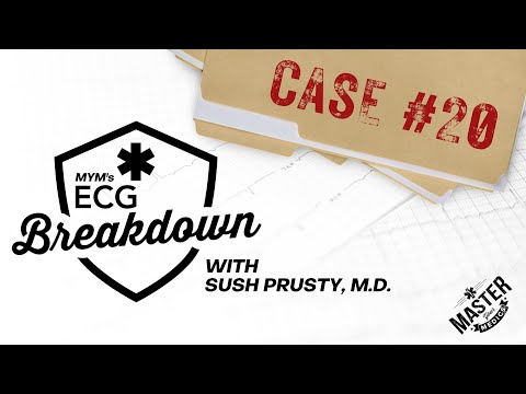Case #20 | ECG Breakdown