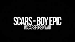 SCARS - BOY EPIC LYRIC