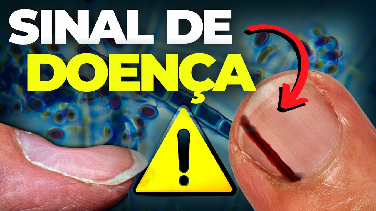 O que as UNHAS REVELAM sobre a sua SAÚDE