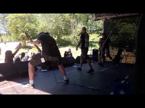 Congenital Anomalies - Detained & Torture@live Ranger Rock