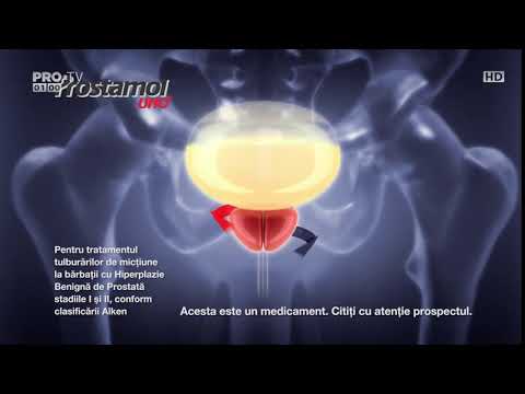 Ureablasm és krónikus prosztatitis
