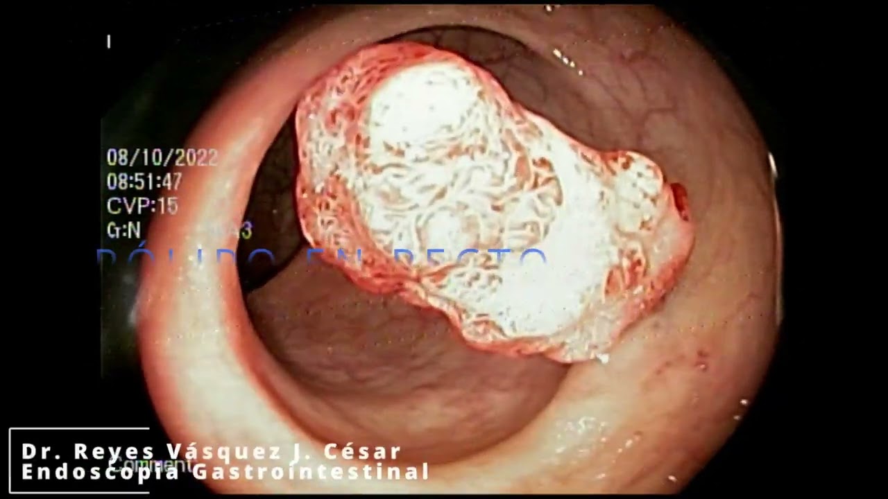 J. César Reyes Vásquez-39