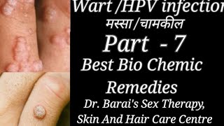Warts /HPV infection /Skin Tag/ मस्सा /चामखीळ -Best Bio Chemic -Part-7