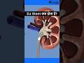 DJ stent क्या होता है ? DJ stent कैसे निकलता है ? | RIRS | Retrograde Intrarenal Surgery # shorts