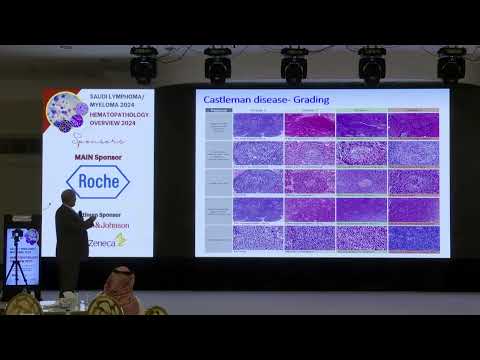 09 Castleman disease – updates | Dr. Ghaleb Elyamany | 26 Oct 2024
