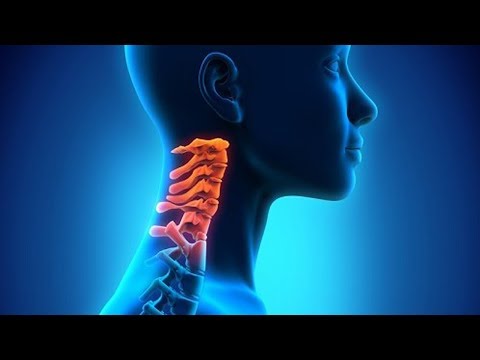 Übung mit zervikaler Übung Osteochondrose Video zurück Übungen, um die Muskeln im Nackenschmerzen zu stärken