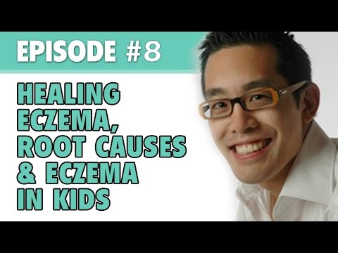 Unguento a gravidanza da eczema Quello che le iniezioni sono date per cura di psoriasi
