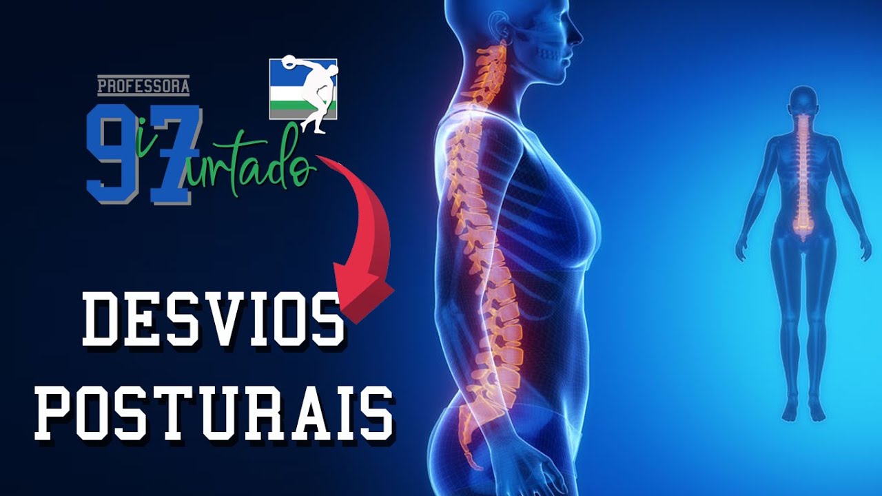 Principais Desvios Posturais