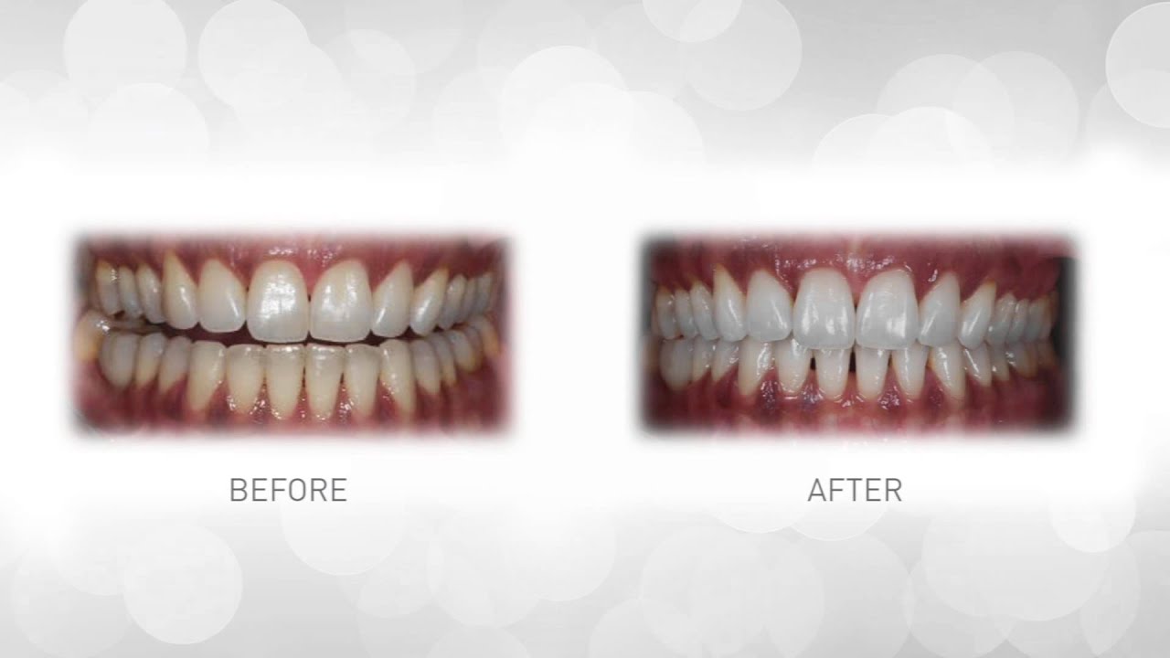 Take a look thumbnail