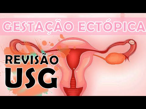 Ultrassonografia na gestação ectópica - O QUE VOCÊ PRECISA SABER