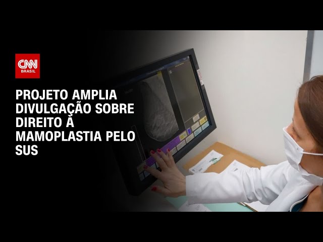 Projeto amplia divulgação sobre direito à mamoplastia pelo SUS | LIVE CNN